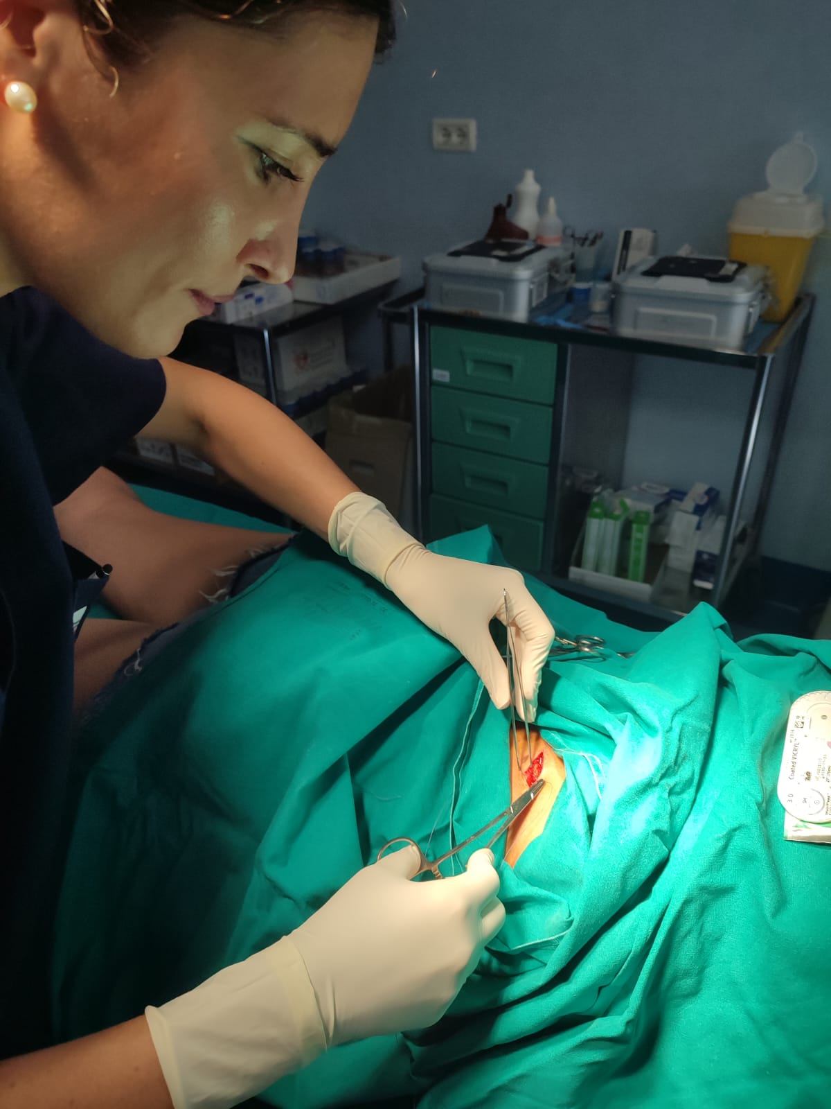Dott.ssa Serena Spennato al lavoro durante un intervento di piccola chirurgia dermatologica